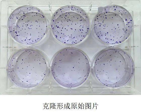 細(xì)胞克隆 細(xì)胞克隆