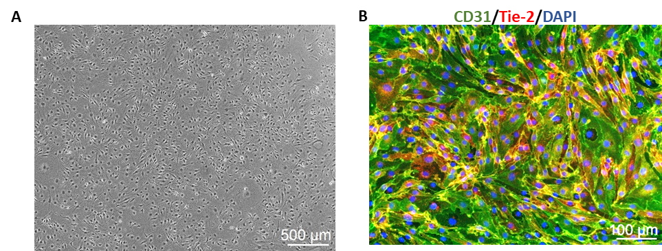 小鼠主動(dòng)脈內(nèi)皮細(xì)胞 (MAOEC)