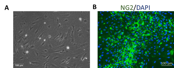 小鼠腦血管周細胞 (MBVP)
