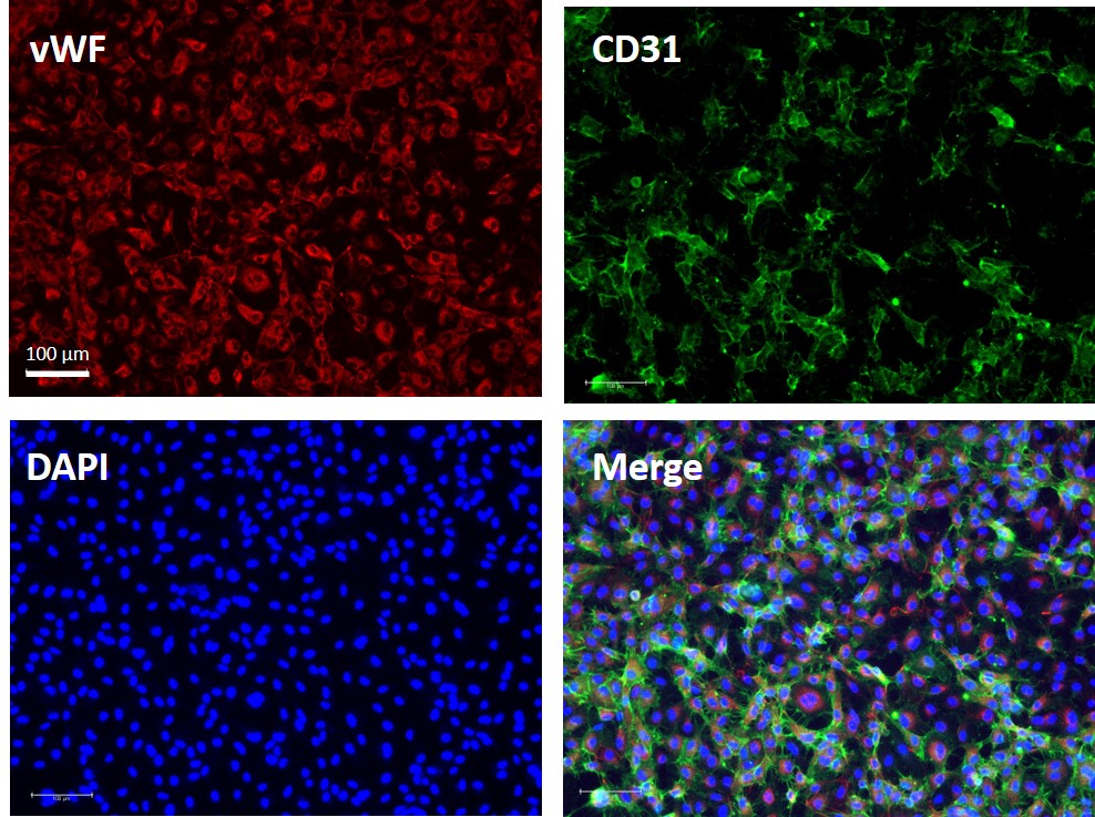 豬肺微血管內(nèi)皮細(xì)胞