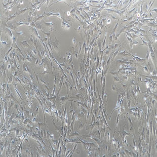 人原代肺動(dòng)脈平滑肌細(xì)胞