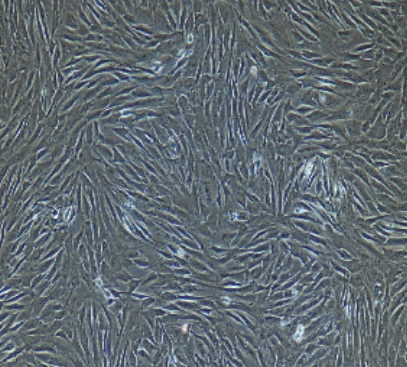 小鼠原代肺大動(dòng)脈外膜成纖維細(xì)胞