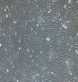 小鼠原代子宮內(nèi)膜間質(zhì)細(xì)胞