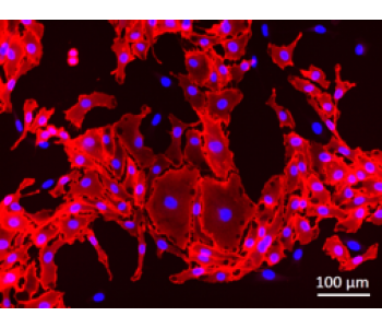 HPMEC 人源肺微血管上皮細(xì)胞