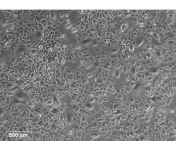 HOSEpiC 人源卵巢表面上皮細(xì)胞