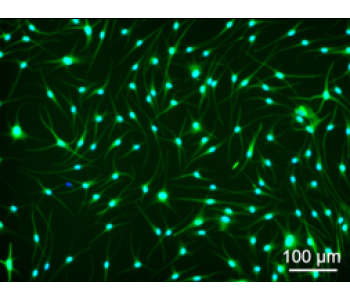 HEM-l 人源表皮黑色素細(xì)胞-Light