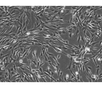 HSwC人源胚胎神經(jīng)膜細(xì)胞