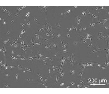 HPSC 人胰腺星狀體細(xì)胞