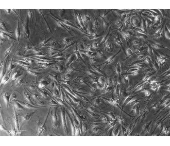 犬主動(dòng)脈內(nèi)皮細(xì)胞 (CnAEC)