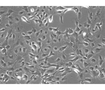小鼠腦血管周細胞 (MBVP)