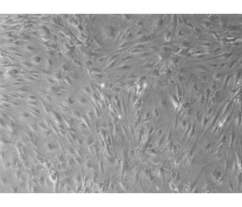 小鼠肺成纖維細胞 (MPF)