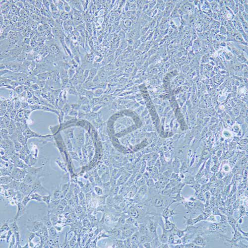 4T1 小鼠乳腺癌細胞