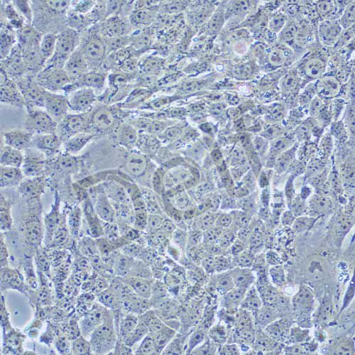 4T1 小鼠乳腺癌細胞