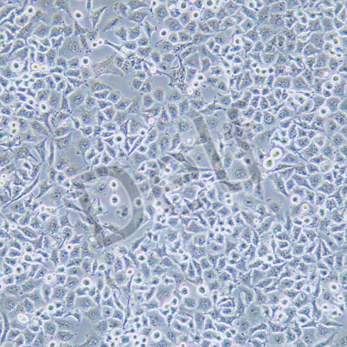 5-8F 人高轉(zhuǎn)移鼻咽癌細(xì)胞系