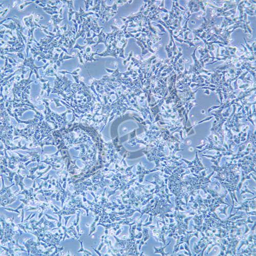 22Rv1 人前列腺癌細胞