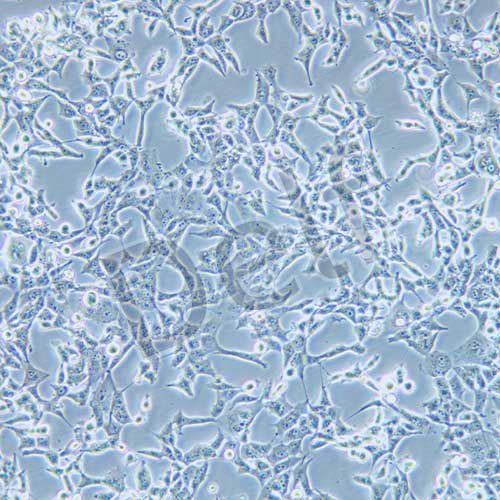 95-D 人高轉(zhuǎn)移肺癌細(xì)胞