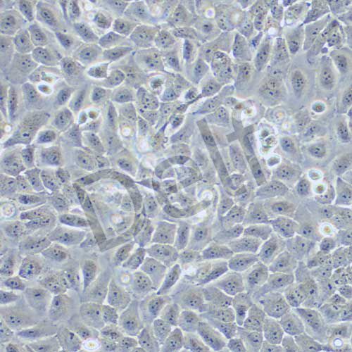 5637 人膀胱癌細(xì)胞