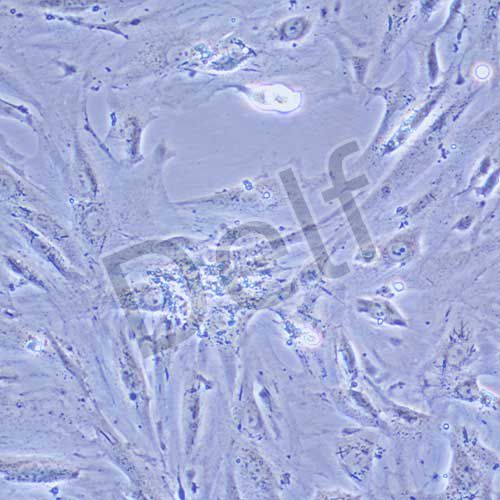 A7R5 大鼠胸大動脈平滑肌細胞