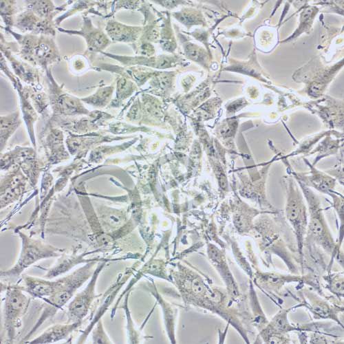 A172 人膠質(zhì)母細(xì)胞瘤細(xì)胞