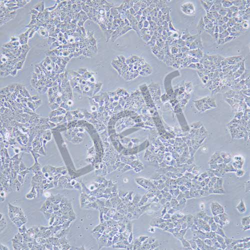 A673 人尤文氏肉瘤細胞