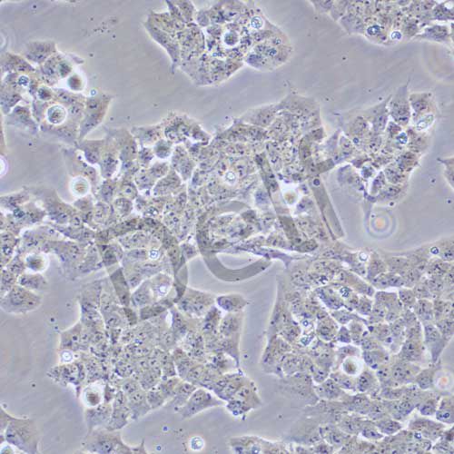 A673 人尤文氏肉瘤細胞