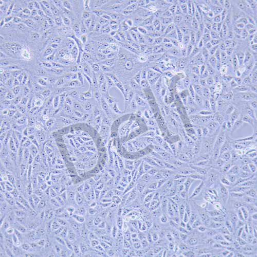 AN3CA人子宮內膜腺癌細胞