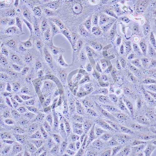 AN3CA人子宮內膜腺癌細胞
