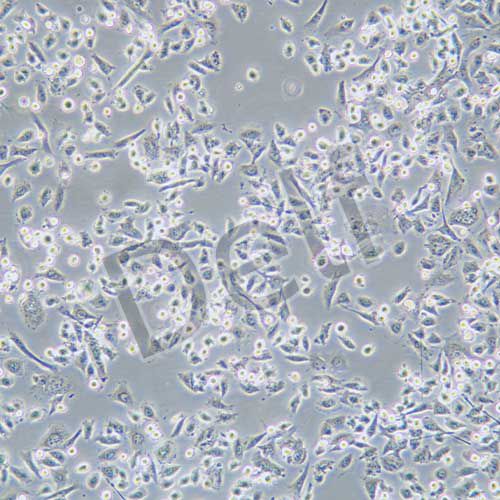 AsPC-1 人轉(zhuǎn)移胰腺腺癌細胞