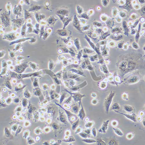 AsPC-1 人轉(zhuǎn)移胰腺腺癌細胞