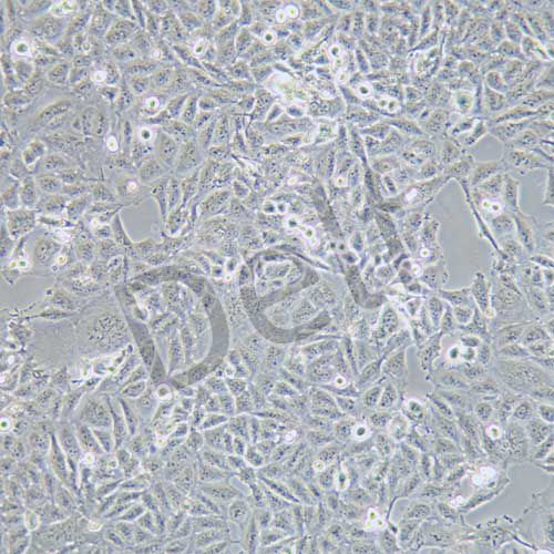 AV3 人宮頸癌細胞