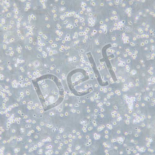 BALL-1 人B淋巴細(xì)胞白血病細(xì)胞