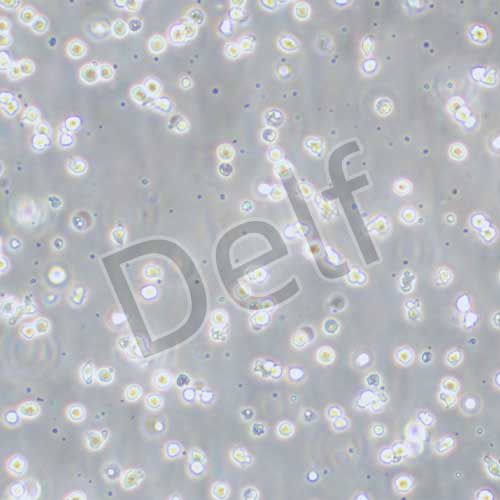 BALL-1 人B淋巴細(xì)胞白血病細(xì)胞