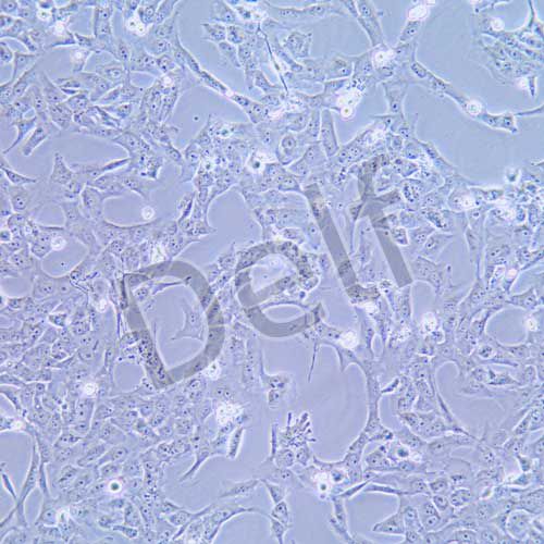 BCPAP 人甲狀腺癌細(xì)胞(乳頭狀)