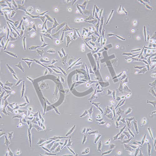 Bel-7405 人肝癌細胞