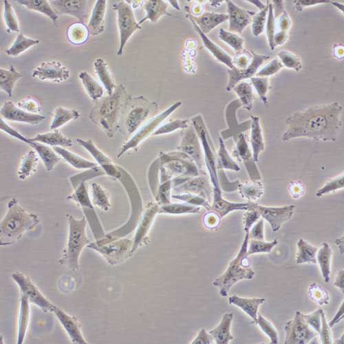 Bel-7405 人肝癌細胞