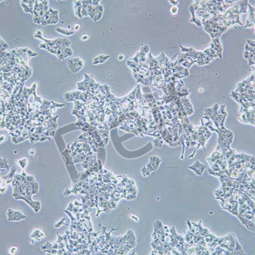 Beta-TC-6 小鼠胰島素瘤胰島β細(xì)胞