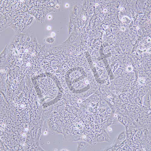 BeWo 人胎盤絨膜癌細(xì)胞