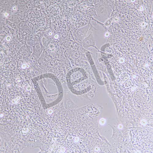 BeWo 人胎盤絨膜癌細(xì)胞