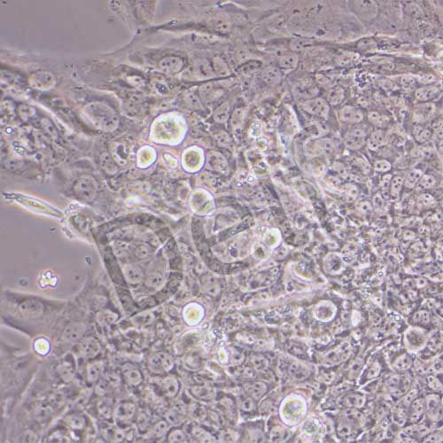 BeWo 人胎盤絨膜癌細(xì)胞