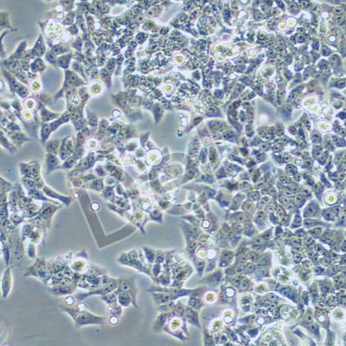 BIU-87 人膀胱癌細胞