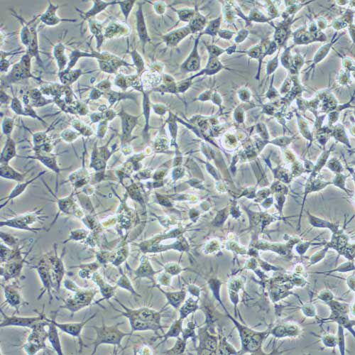 C666-1 人鼻咽癌細(xì)胞