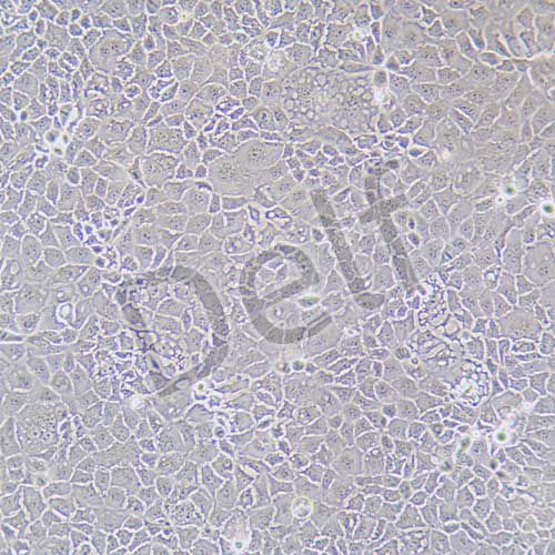 Caco-2 人結腸癌細胞