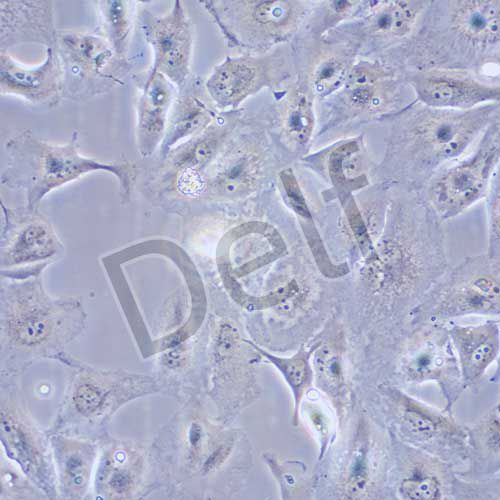 Caki-2 人腎透明細(xì)胞癌細(xì)胞