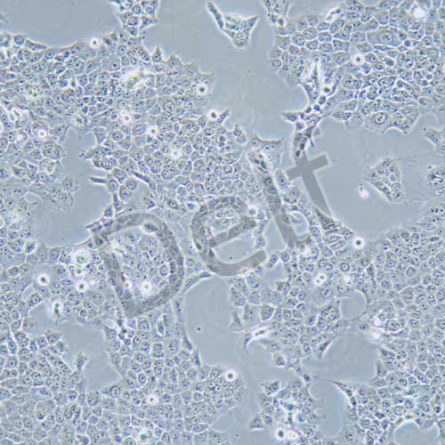 CAL-27 人舌鱗癌細(xì)胞