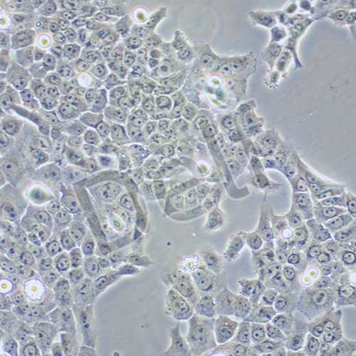 CAL-27 人舌鱗癌細(xì)胞