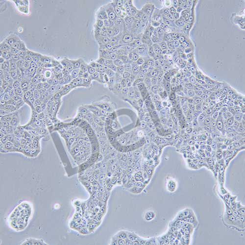 Calu-3 人肺腺癌細胞