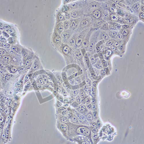 Calu-3 人肺腺癌細胞