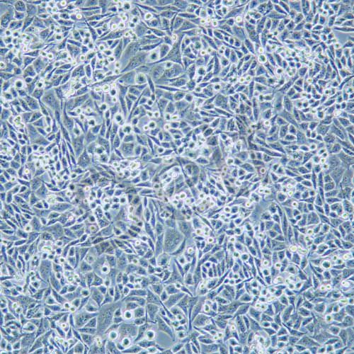calu-6 人退行性癌細(xì)胞