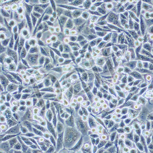calu-6 人退行性癌細(xì)胞