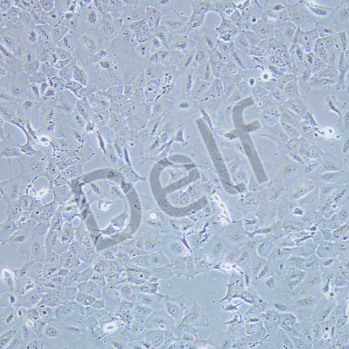 Caov-3 人卵巢腺癌細胞